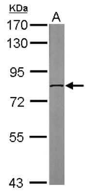Western Blot: DDX3 Antibody [NBP2-16133]