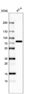 Western Blot: DDX3 Antibody [NBP2-56579]