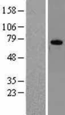 Western Blot: DDX3X Overexpression Lysate [NBL1-09795]