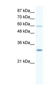 Western Blot: DDX31 Antibody [NBP1-57349]