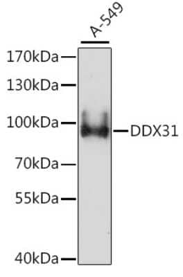 Western Blot: DDX31 AntibodyAzide and BSA Free [NBP2-92273]