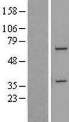 Western Blot: DDX31 Overexpression Lysate [NBL1-09792]