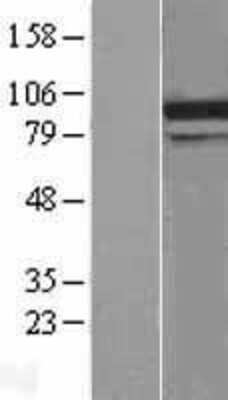 Western Blot: DDX31 Overexpression Lysate [NBL1-09793]