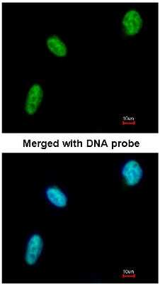 Immunocytochemistry/ Immunofluorescence: DDX39 Antibody [NBP1-31407]