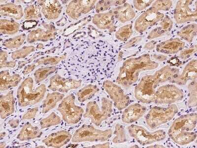 Immunohistochemistry-Paraffin: DDX39 Antibody [NBP2-98622]