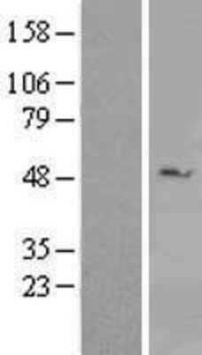 Western Blot: DDX39 Overexpression Lysate [NBL1-09794]