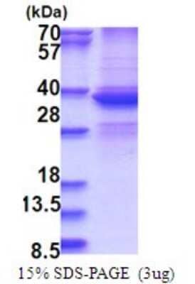 SDS-PAGE: Recombinant Human DDX39 His Protein [NBP2-51731]