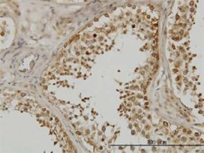 Immunohistochemistry-Paraffin: DDX3 Antibody (2D7) [H00008653-M01]
