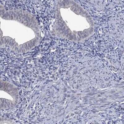 Immunohistochemistry-Paraffin: DDX3Y Antibody [NBP3-16963]