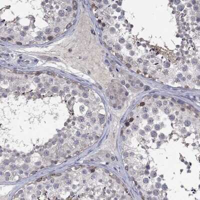 Immunohistochemistry-Paraffin: DDX3Y Antibody [NBP3-16963]