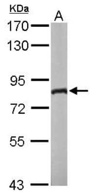Western Blot: DDX3 Antibody [NBP1-32780]