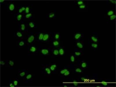 Immunocytochemistry/ Immunofluorescence: DDX41 Antibody (2F4) [H00051428-M01]