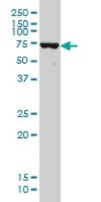 Western Blot: DDX41 Antibody (2F4) [H00051428-M01]