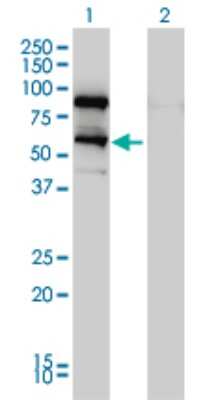 Western Blot: DDX41 Antibody (2F4) [H00051428-M01]