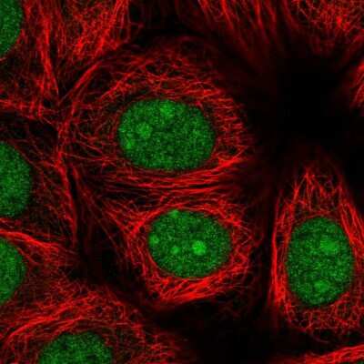 Immunocytochemistry/ Immunofluorescence: DDX41 Antibody [NBP2-48918]