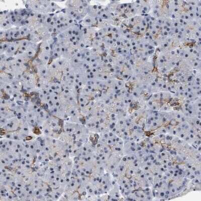 Immunohistochemistry-Paraffin: DDX41 Antibody [NBP1-89297]