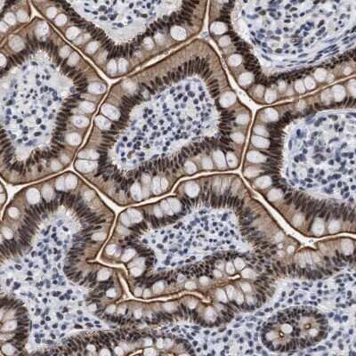 Immunohistochemistry-Paraffin: DDX41 Antibody [NBP1-89297]