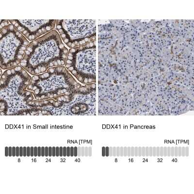 Immunohistochemistry-Paraffin: DDX41 Antibody [NBP1-89297]