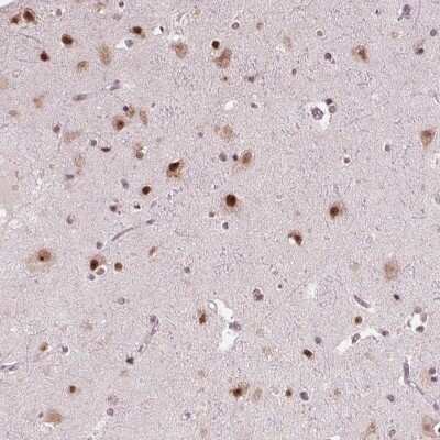 Immunohistochemistry-Paraffin: DDX41 Antibody [NBP2-48918]