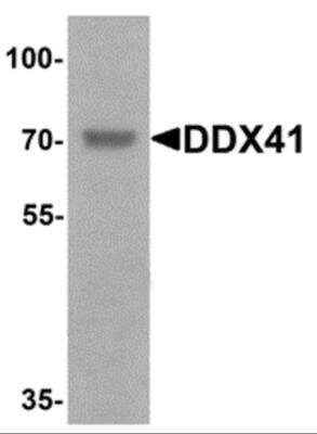 Western Blot: DDX41 AntibodyBSA Free [NBP2-82061]