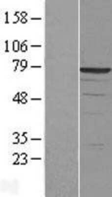 Western Blot: DDX41 Overexpression Lysate [NBL1-09797]