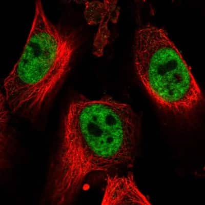 Immunocytochemistry/ Immunofluorescence: DDX42 Antibody [NBP1-87133]