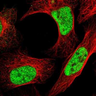 Immunocytochemistry/ Immunofluorescence: DDX42 Antibody [NBP1-87134]