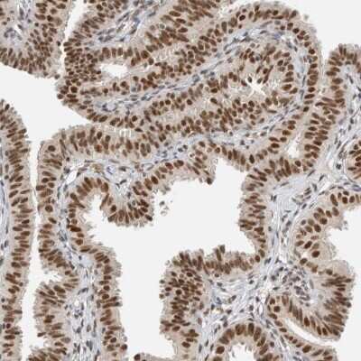 Immunohistochemistry-Paraffin: DDX42 Antibody [NBP1-87133]