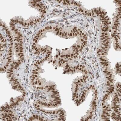 Immunohistochemistry-Paraffin: DDX42 Antibody [NBP1-87133]