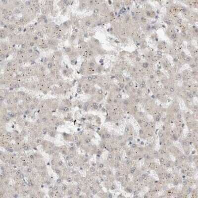 Immunohistochemistry-Paraffin: DDX42 Antibody [NBP1-87133]