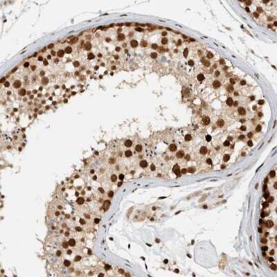Immunohistochemistry-Paraffin: DDX42 Antibody [NBP1-87133]