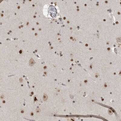 Immunohistochemistry-Paraffin: DDX42 Antibody [NBP1-87134]