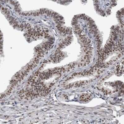 Immunohistochemistry-Paraffin: DDX42 Antibody [NBP1-87134]