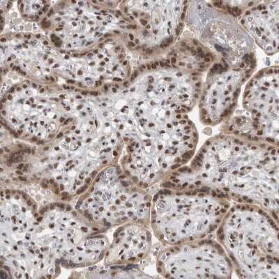 Immunohistochemistry-Paraffin: DDX42 Antibody [NBP1-87134]