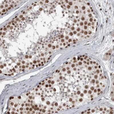 Immunohistochemistry-Paraffin: DDX42 Antibody [NBP1-87134]