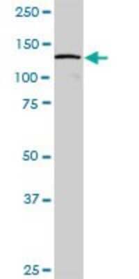 Western Blot: DDX42 Antibody [H00011325-B01P]