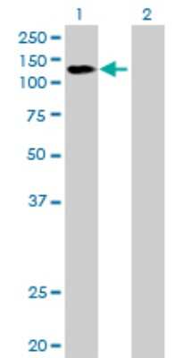 Western Blot: DDX42 Antibody [H00011325-B01P]