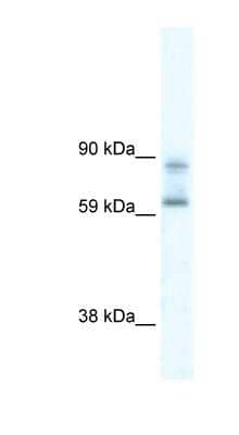 Western Blot: DDX42 Antibody [NBP1-57335]