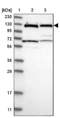 Western Blot: DDX42 Antibody [NBP1-87135]