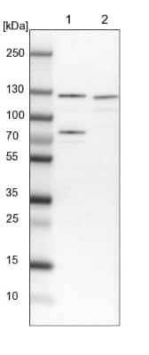 Western Blot: DDX42 Antibody [NBP1-87135]