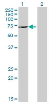 Western Blot: DDX43 Antibody (3G12) [H00055510-M07]