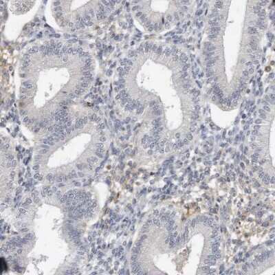 Immunohistochemistry-Paraffin: DDX43 Antibody [NBP1-85419]