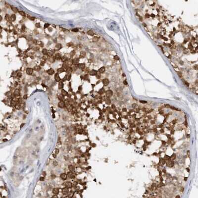 Immunohistochemistry-Paraffin: DDX43 Antibody [NBP1-85419]