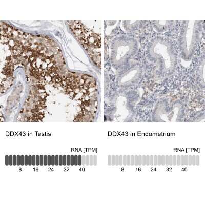 Immunohistochemistry-Paraffin: DDX43 Antibody [NBP1-85419]