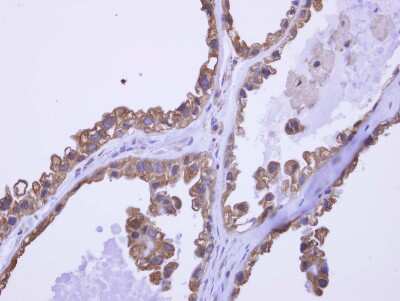 Immunohistochemistry-Paraffin: DDX43 Antibody [NBP2-16136]