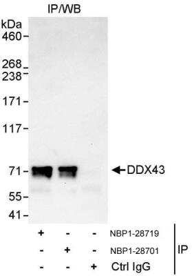 Immunoprecipitation: DDX43 Antibody [NBP1-28701]