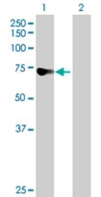 Western Blot: DDX43 Antibody [H00055510-B01P]