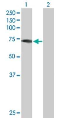 Western Blot: DDX43 Antibody [H00055510-D01P]