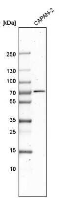 Western Blot: DDX43 Antibody [NBP1-85419]