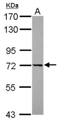 Western Blot: DDX43 Antibody [NBP2-16136]